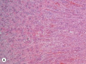 FIGURE 22-3, Non-autolysed (A) and autolysed (B) renal sections demonstrating loss of tubular nuclear basophilia.