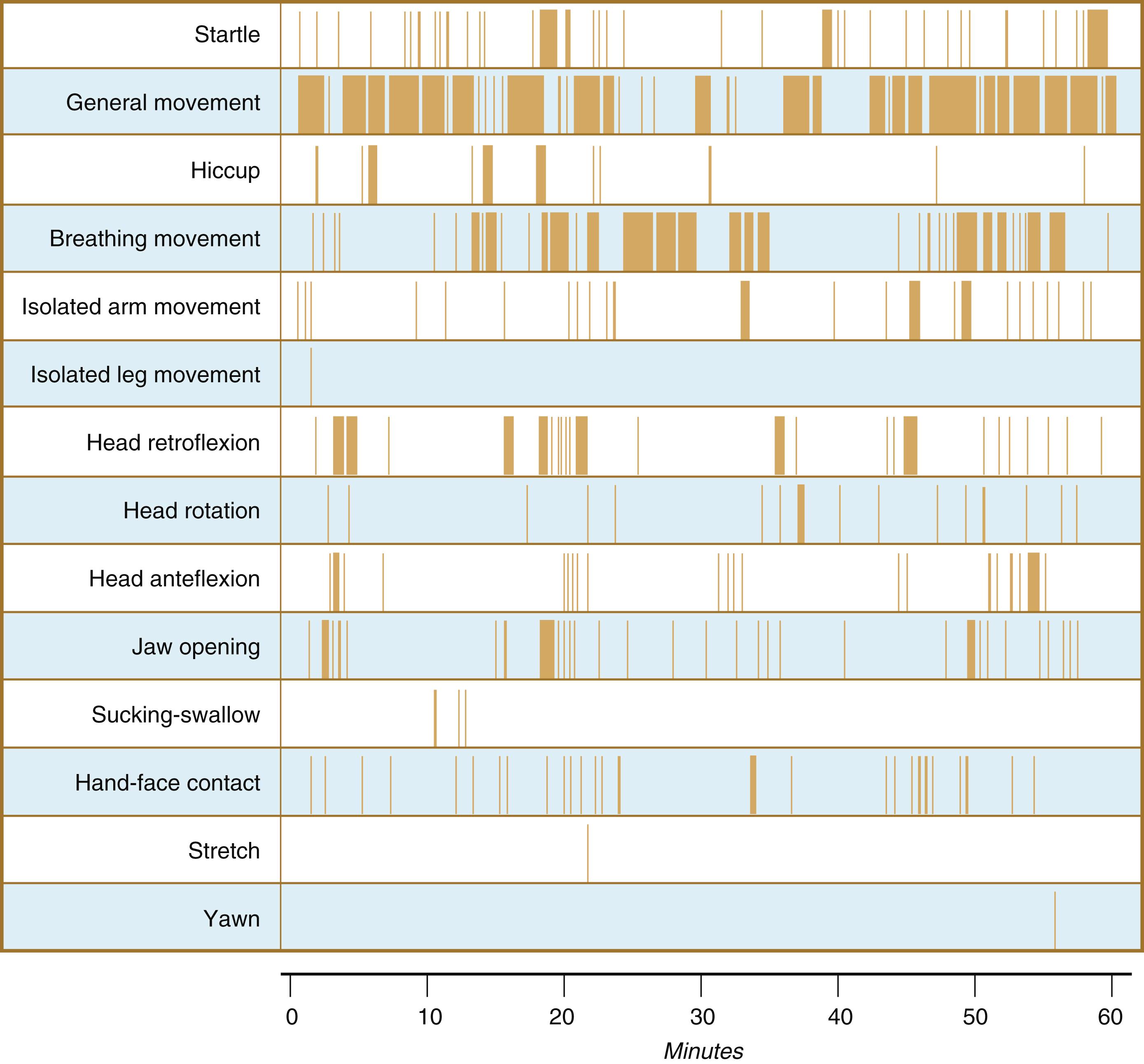 Fig. 18.8, Actogram record of types of movements of a 14-week fetus taken over 60 minutes.