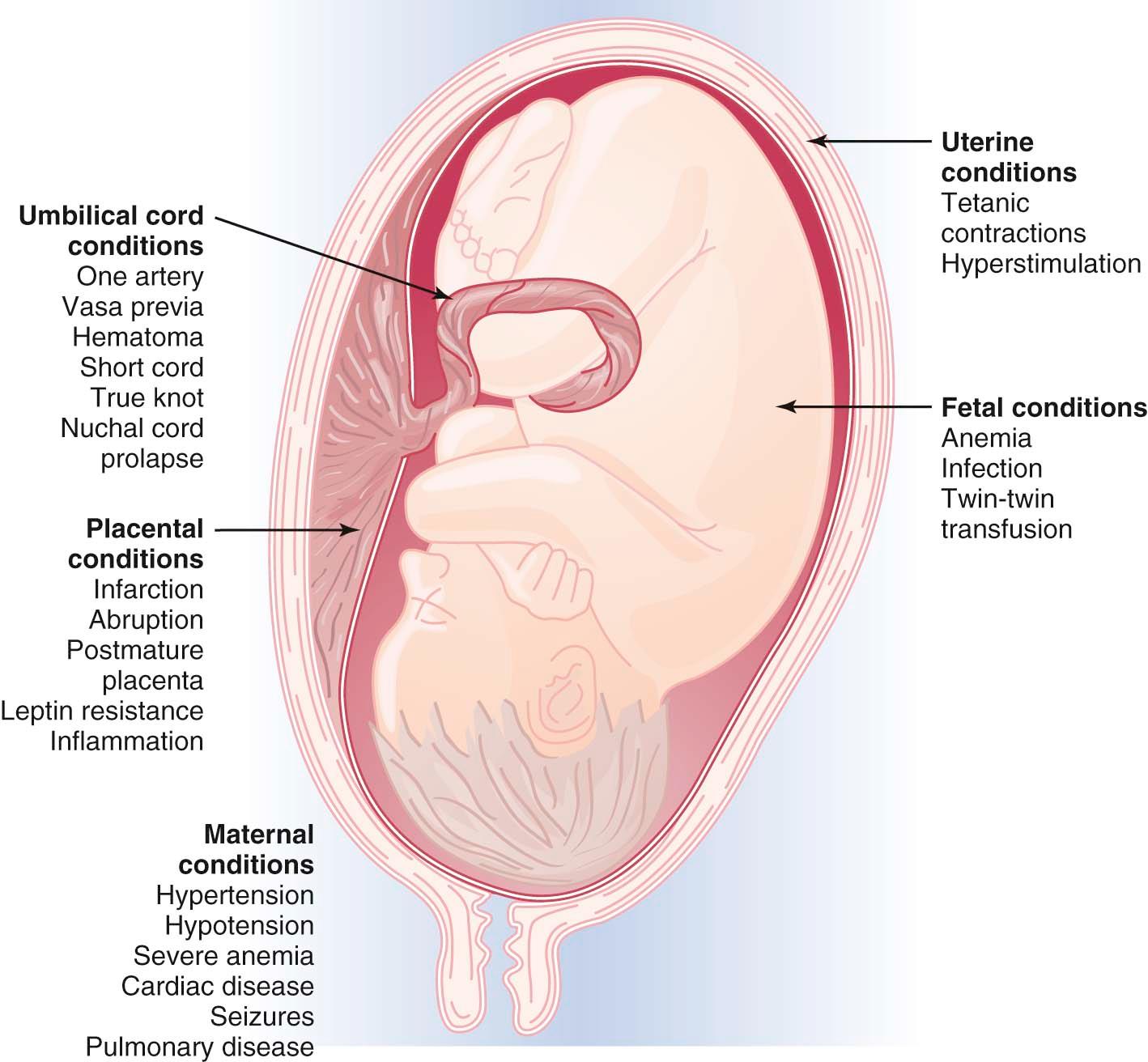 FIGURE 9-2, Clinical conditions associated with fetal distress in labor.