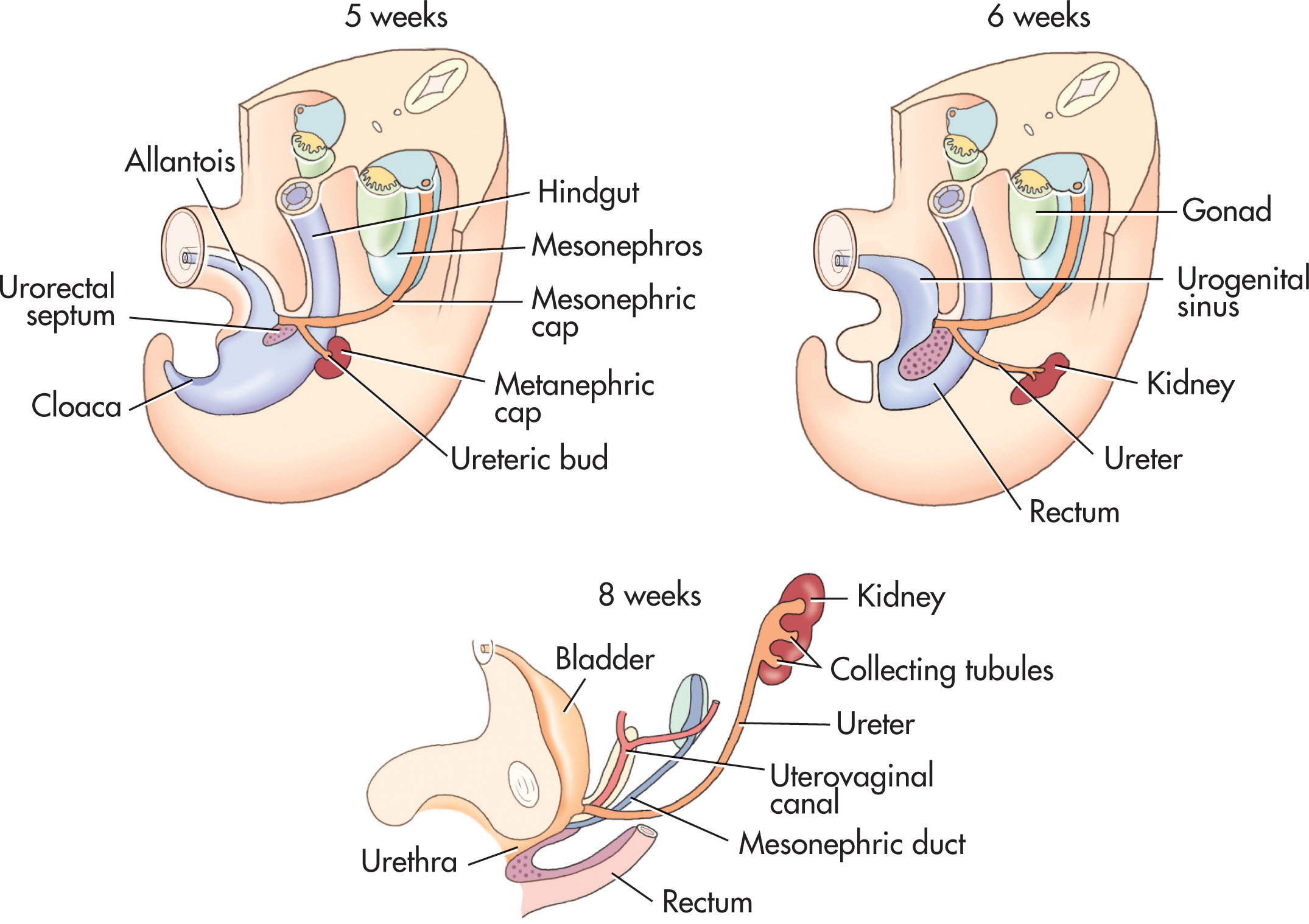 Fig. 64.2, Early embryologic development of the urinary system.