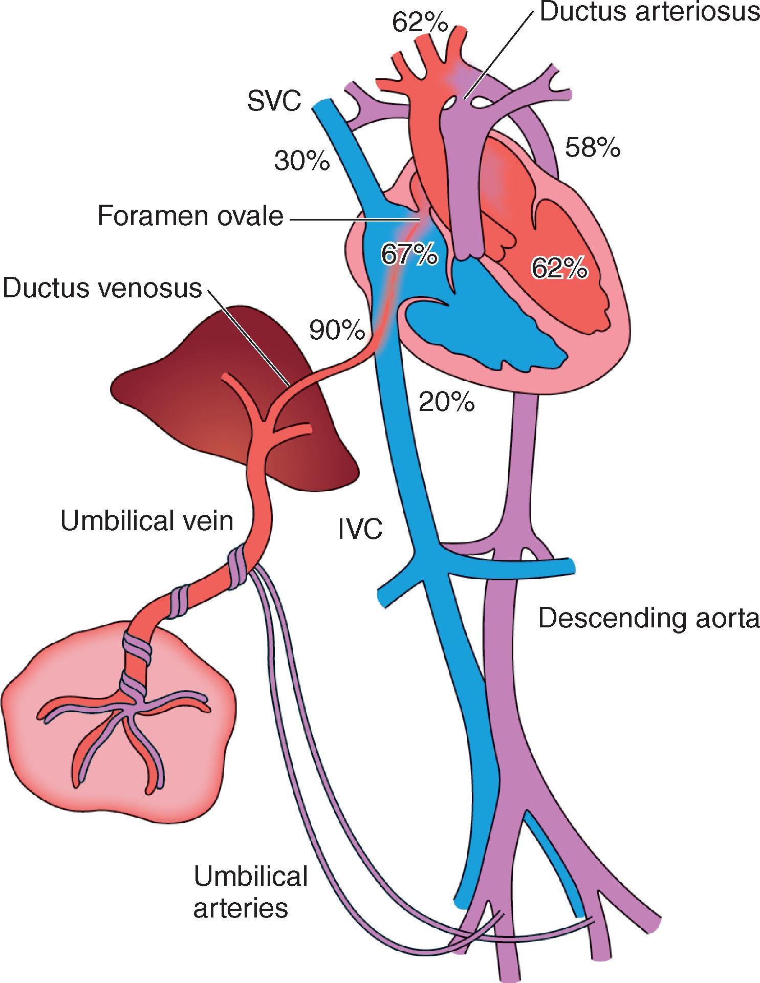 Fig. 4.1, The diagram shows the organisation of the fetal circulation to include the placenta as the source of oxygenation, with the three fetal shunts, the ductus venosus, foramen ovale and ductus arteriosus allowing oxygenated blood to bypass the fetal liver and lungs. Percentage figures relate to the oxygen saturation at that point in the circulation. IVC , Inferior vena cava; SVC , superior vena cava.