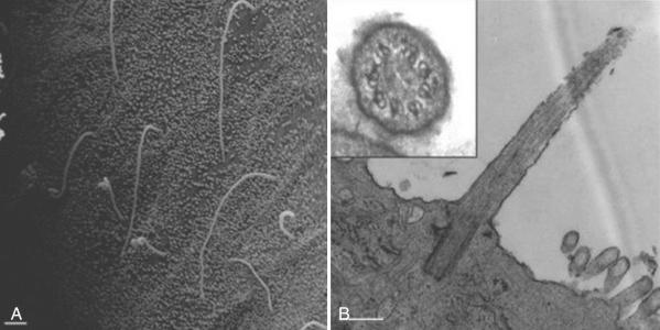 Fig. 64-2, Primary cilia extend from the apical surface of cholangiocytes, detect flow of fluid over the surface of the cell, and transduce flow information into the cell interior. A, Scanning electron micrograph of primary cilia extending from the apical surface of rat intrahepatic bile duct epithelial cells (cholangiocytes). B, Transmission electron micrograph showing the ultrastructure at the base of a primary cilium including the basal body at the base of the primary cilium and the primary cilium extending into the lumen. The inset shows a cross section of a primary cilium and the ring of microtubules that form the core of the primary cilium.