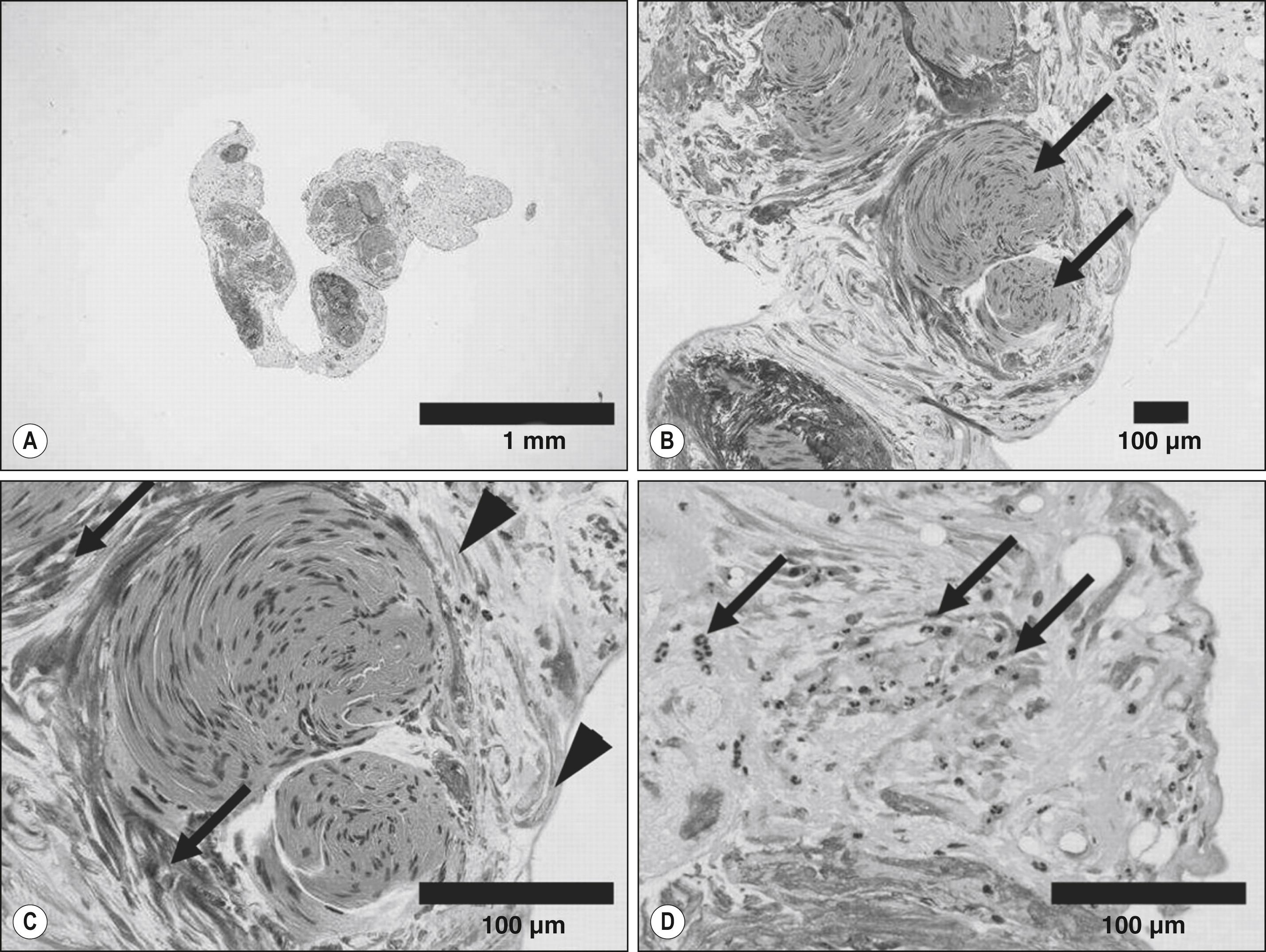 Fig. 86.1, Paraffin-embedded HE staining of a filament.