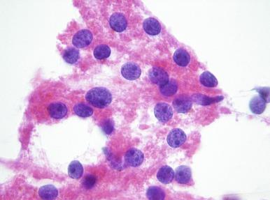 Fig. 4.2, Proximal tubular cells.
