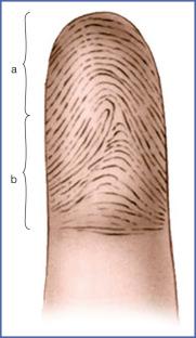 Fig. 9.3, Positioning of Dermatoglyphics.