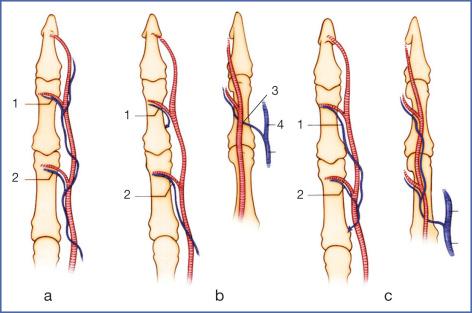 Fig. 9.41, Deep Venous System.