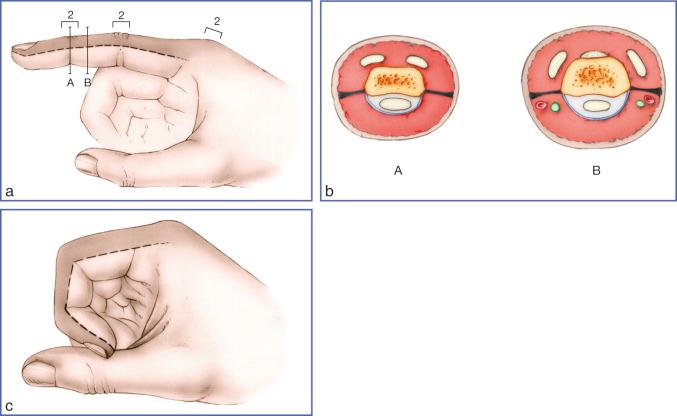 Fig. 9.56, Skin of the Dorsal Surface of Fingers.