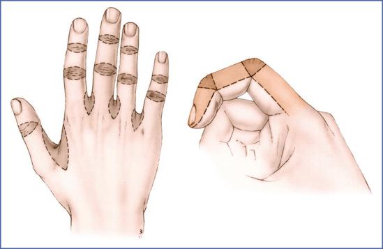 Fig. 9.57, Topography of Skin Functional Units on Dorsal Surface of Fingers