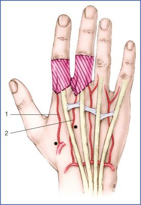 Fig. 9.60, Vascularization of the Dorsal Skin of the Fingers.