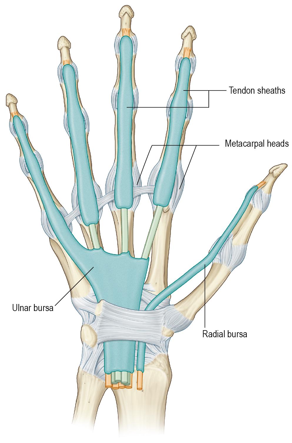 FIGURE 5.4, The proximal extensions of the ulnar and radial bursa that communicate with the flexor sheaths.