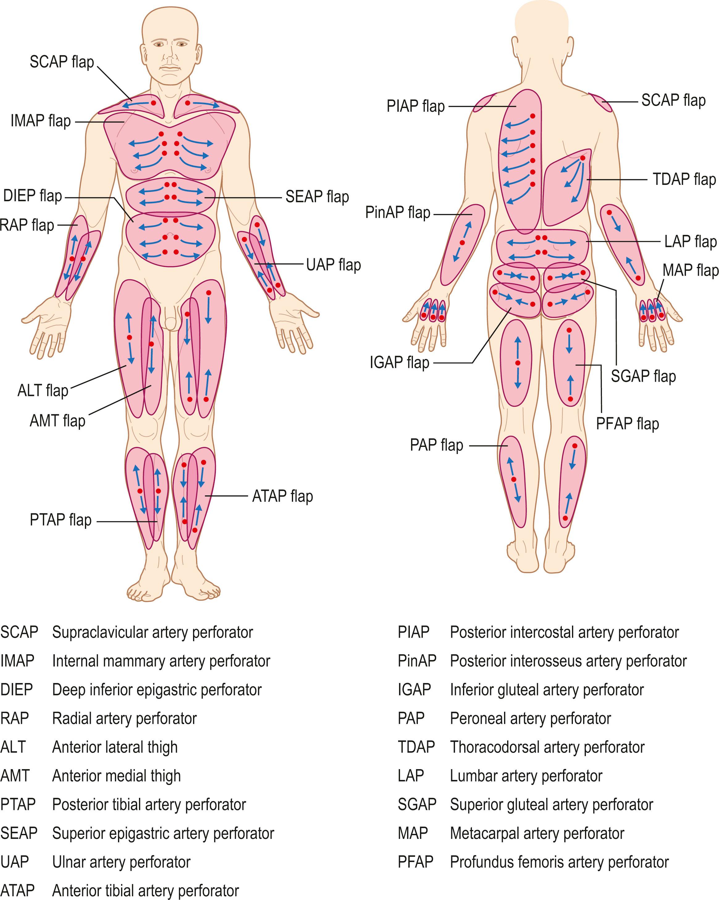 Figure 24.18, Orientation of the perforators should be understood and utilized when designing flaps. The skin paddle orientation should be based on the direction of the linking vessels, which is axial in the extremities and perpendicular to the midline in the trunk.