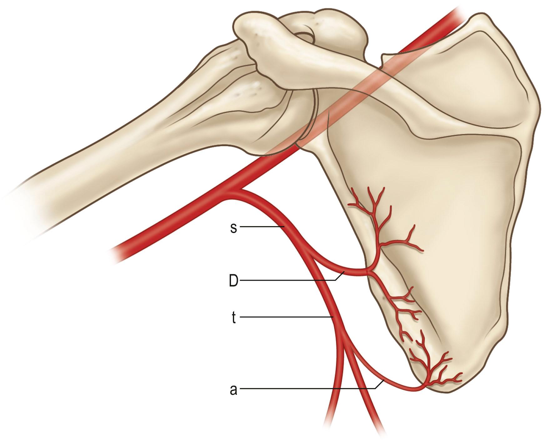 Figure 24.25, Independent vascularized segments of the scapula based on circumflex scapular and thoracodorsal pedicles. s, Subscapular artery; D, circumflex scapular artery; t, thoracodorsal artery; a, scapular arterial branch.