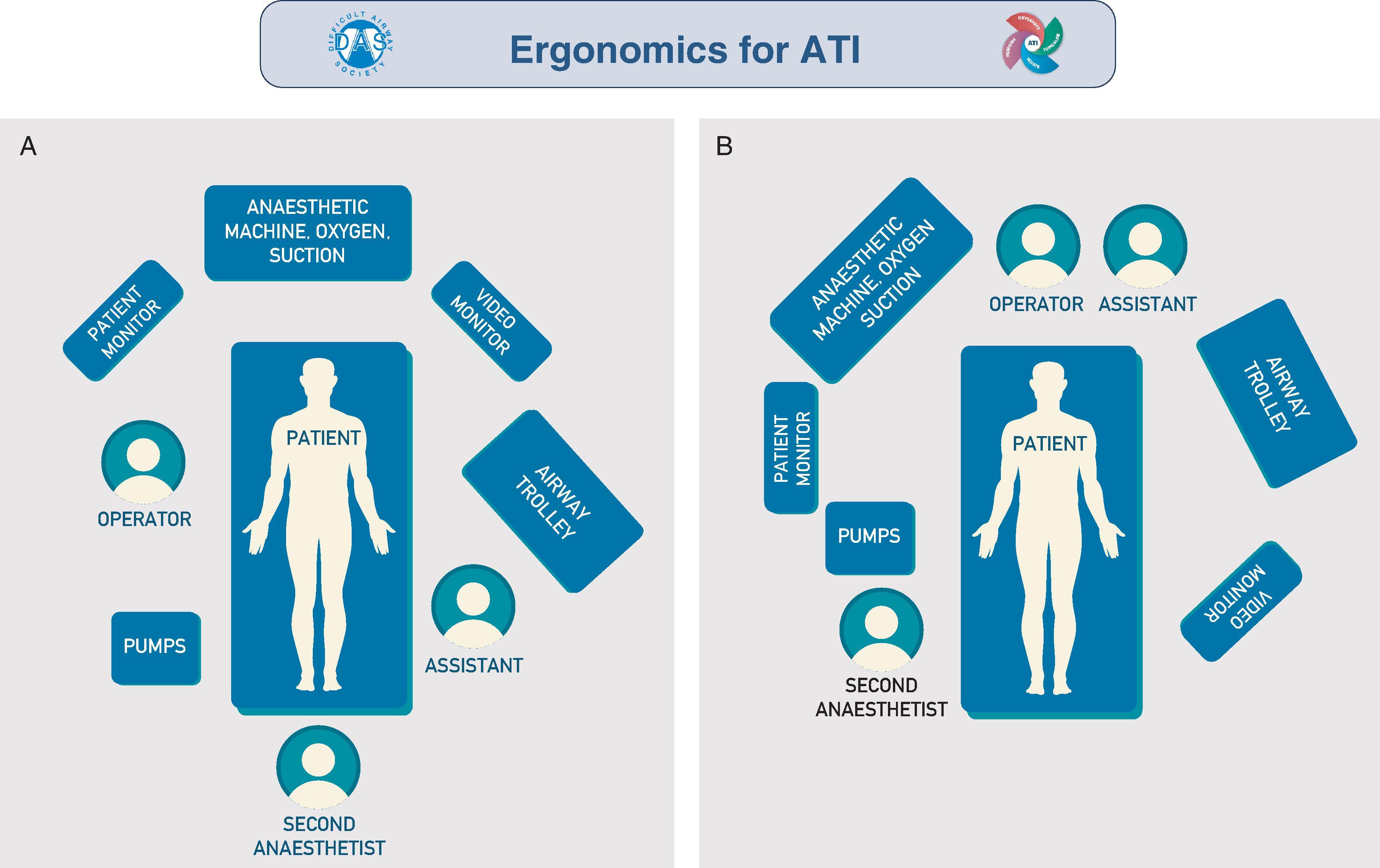 Fig. 24.14, Examples of ergonomics for awake tracheal intubation (ATI). The primary operator should have a direct line of sight of the patient, video monitor, and patient monitor, as well as immediate access to infusion pumps, anesthetic machine, suction, and oxygen delivery device. If a second anesthesiologist is present, they should be positioned with a direct line of sight of the patient and have immediate access to infusion pumps, as well as be able to access all other equipment. The assistant’s primary position should be with immediate access to the airway trolley and in proximity to the operator. (A) Awake tracheal intubation performed with the operator positioned facing the patient who is in a sitting up position. (B) Awake tracheal intubation performed with the operator positioned behind the supine/semirecumbent patient. This figure forms part of the Difficult Airway Society guidelines for ATI in adults and should be used in conjunction with the text.