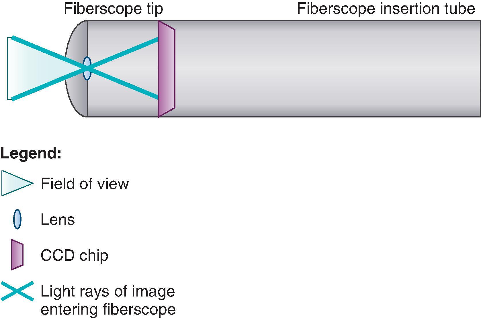 Fig. 24.3, Flexible scope tip mechanics: field of view. Insertion tip transmission of light through a lens to the charge-coupled device (CCD) chip.