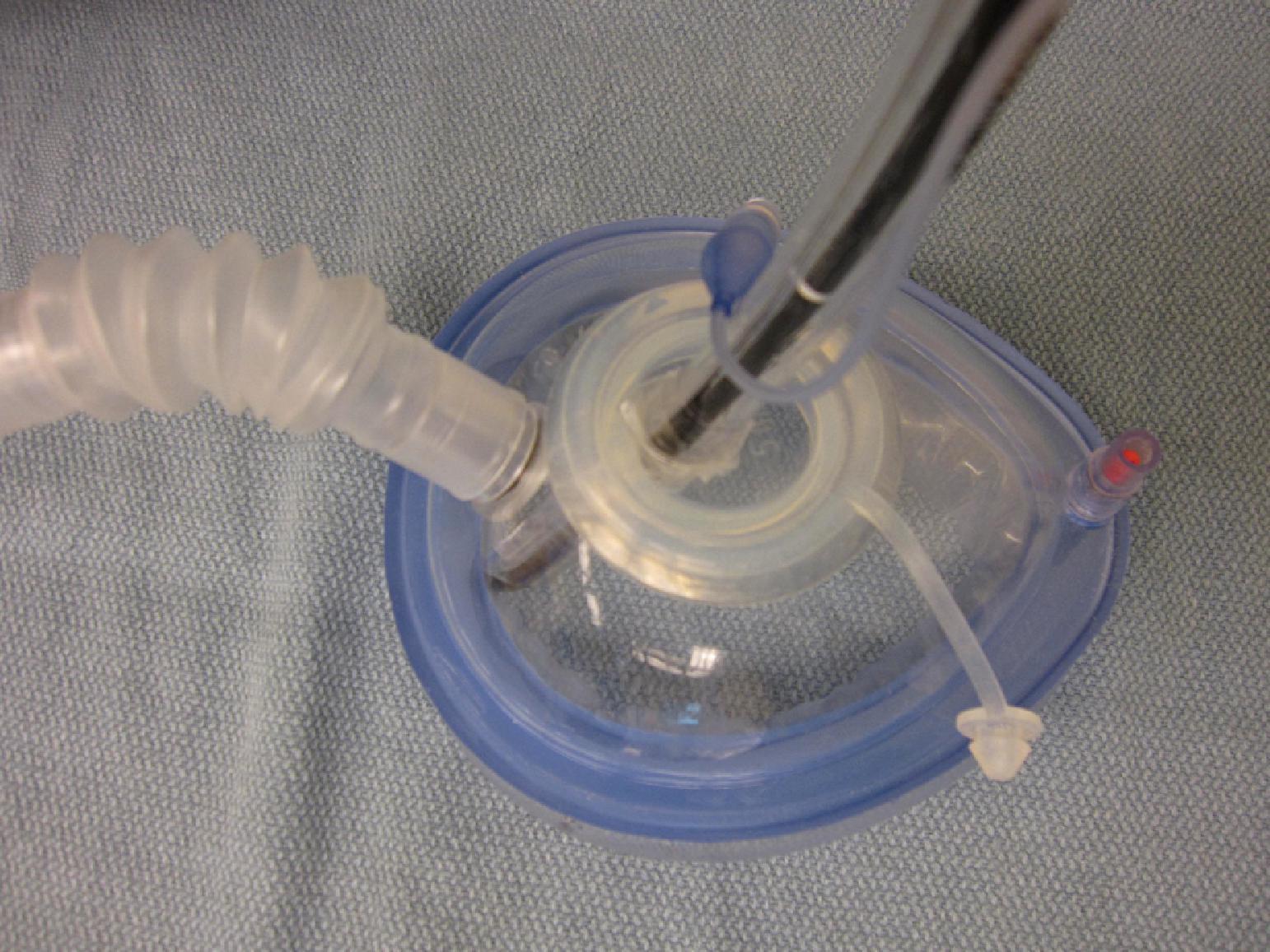 Fig. 24.10, Endoscopy mask with connector tubing for ventilation (on the left ) and a snug diaphragm (on top ) for the passage of a fiberoptic bronchoscope within an endotracheal tube.