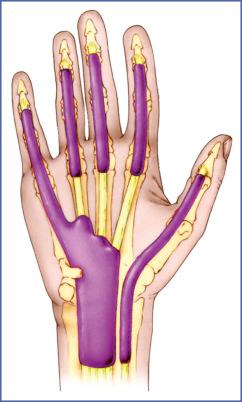 Fig. 10.2, Organization of Synovial Sheaths of Flexor Tendons.