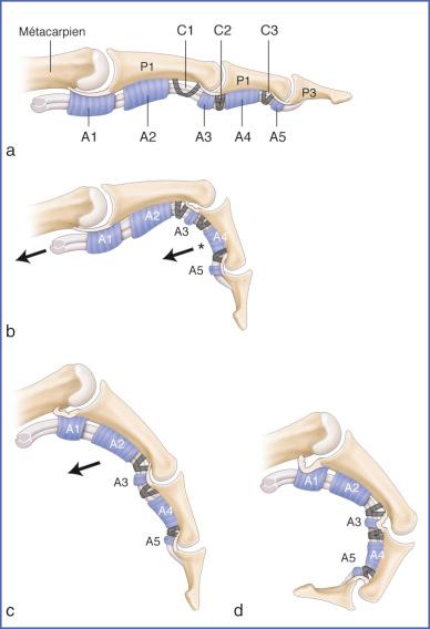 Fig. 10.3, Pulley Biomechanics: Architecture of Fibrous Flexor Sheath.