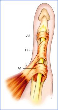 Fig. 10.4, Flexor Pulleys of Thumb.