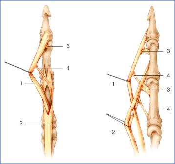 Fig. 10.5, Organization of the vascular system of the deep (1) and superficial (2) flexor tendons in the flexor sheath. Each tendon is vascularized by a short (3) and long (4) vincula.