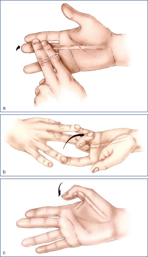 Fig. 10.8, (a) Test of the flexor digitorum profundus: the MCP and PIP joint are kept in extension. The patient must perform an active flexion of the DIP joint. (b) Test of the flexor digitorum superficialis: all of the fingers are kept in extension. The tested finger is free. Only an intact superficial flexor can bend the PIP joint. (c) Test of the flexor pollicis longus: the patient must actively bend the IP joint.