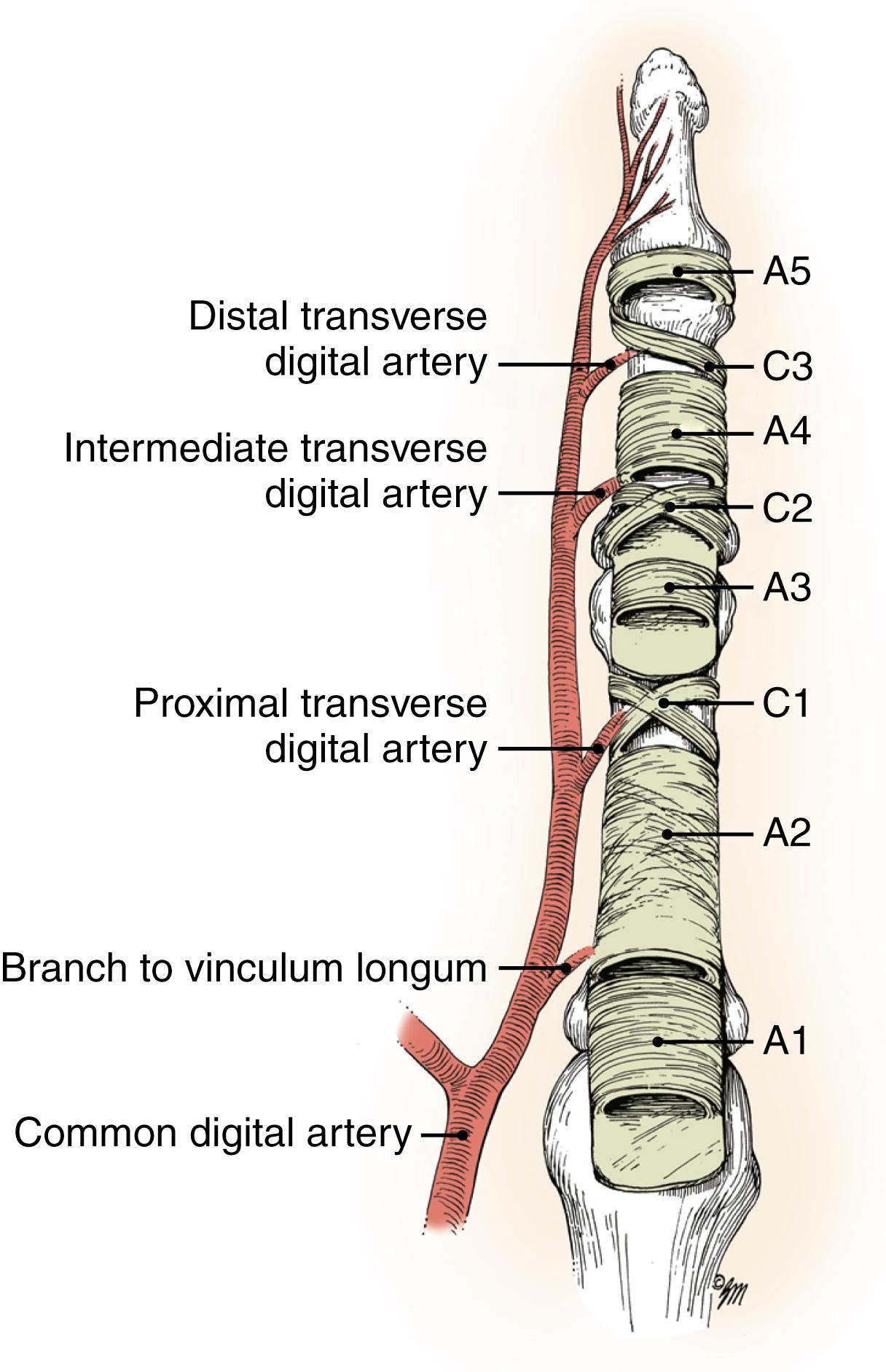 Fig. 6.4, Fibrous retinacular sheath starts at the neck of the metacarpal and ends at the distal phalanx. Condensations of the sheath form the flexor pulleys, which can be identified as five heavier annular bands and three filmy cruciform ligaments (see text).