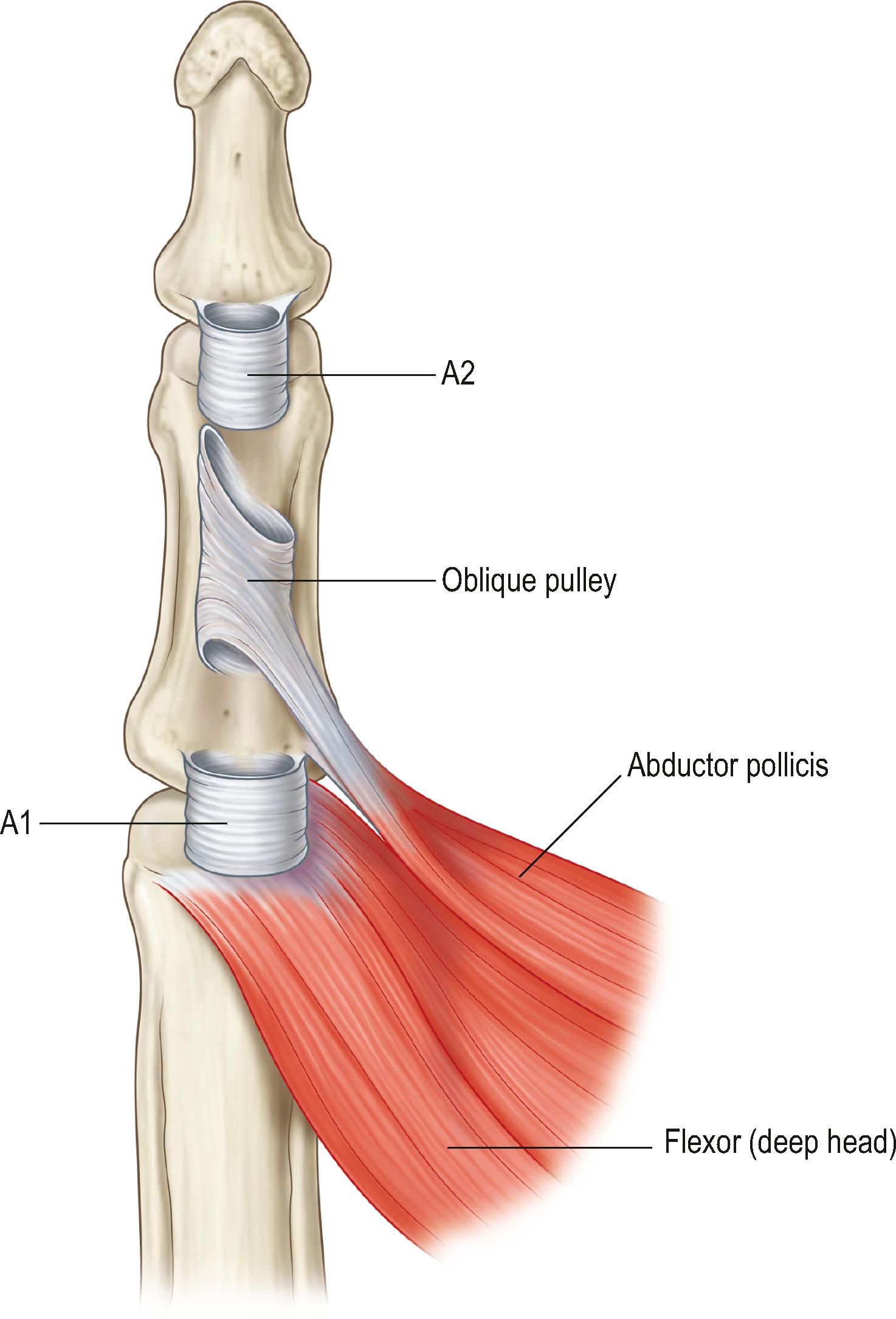 Figure 9.2, Locations of flexor pulleys of the thumb. There are three pulleys in the thumb: A1, oblique, and A2 pulley, from distal to proximal.