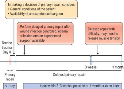 Figure 24.1, A decision-making flowchart of primary and delayed primary flexor tendon repairs.