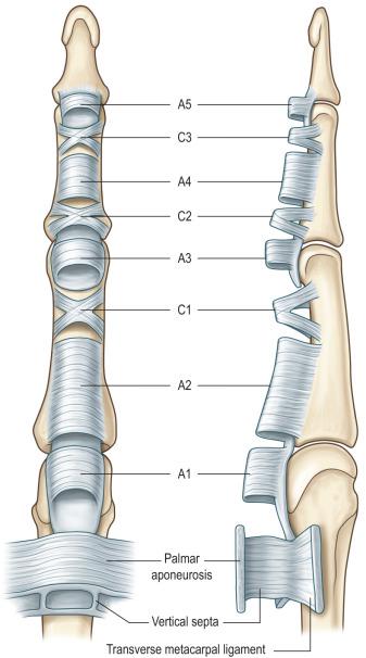 Figure 24.2, Annular pulleys (condensed, rigid, and heavier annular bands) and cruciate pulleys (filmy cruciform bands) are present in the fingers. There are five annular pulleys (A1–A5), three cruciate pulleys (C1–C3), and one palmar aponeurosis pulley.
