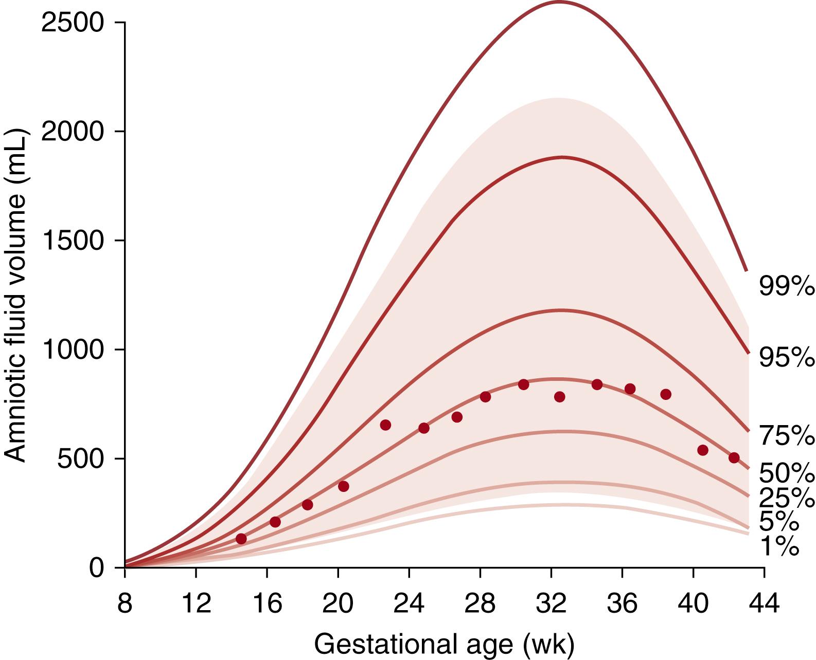 Fig. 105.3, Normal range of amniotic fluid volume in human gestation.