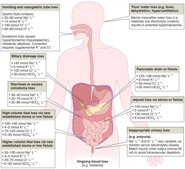 Fig. 12.4, Fluid and electrolyte losses in the adult surgical patient, absolute losses being dependent on measured volumes.