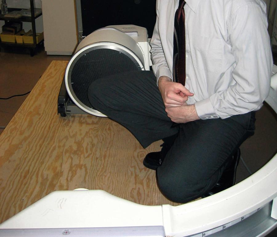 FIG 17.1, A subject performing a deep knee bend to maximum weight-bearing flexion while the knee is under fluoroscopic surveillance.