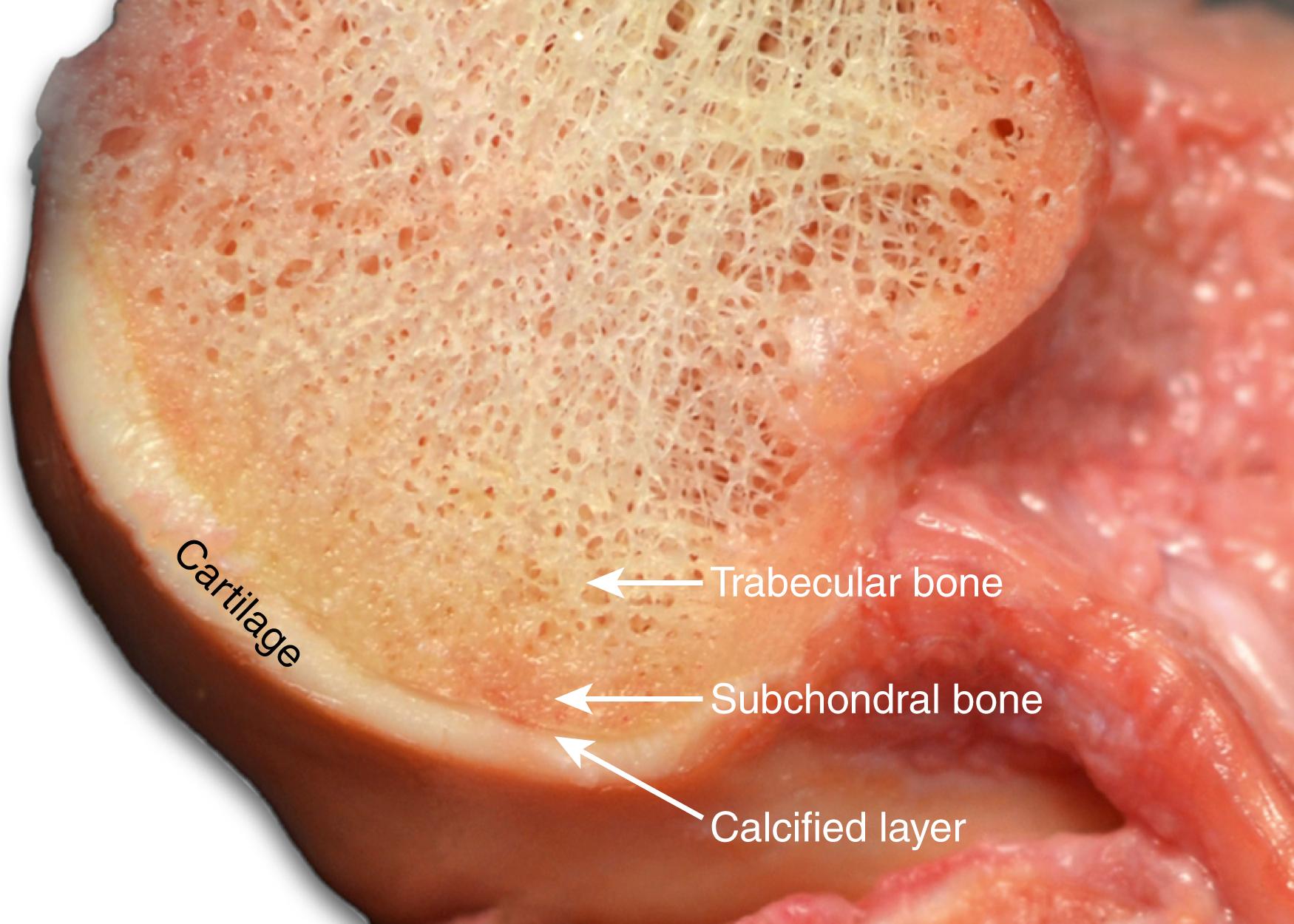 Fig. 22.2, Cadaveric dissection image of a hemi-condyle as viewed from the intercondylar notch demonstrating a sagittal view of the superficial and inner layers: cartilage, calcified layer and the differences between subchondral and trabecular bone.