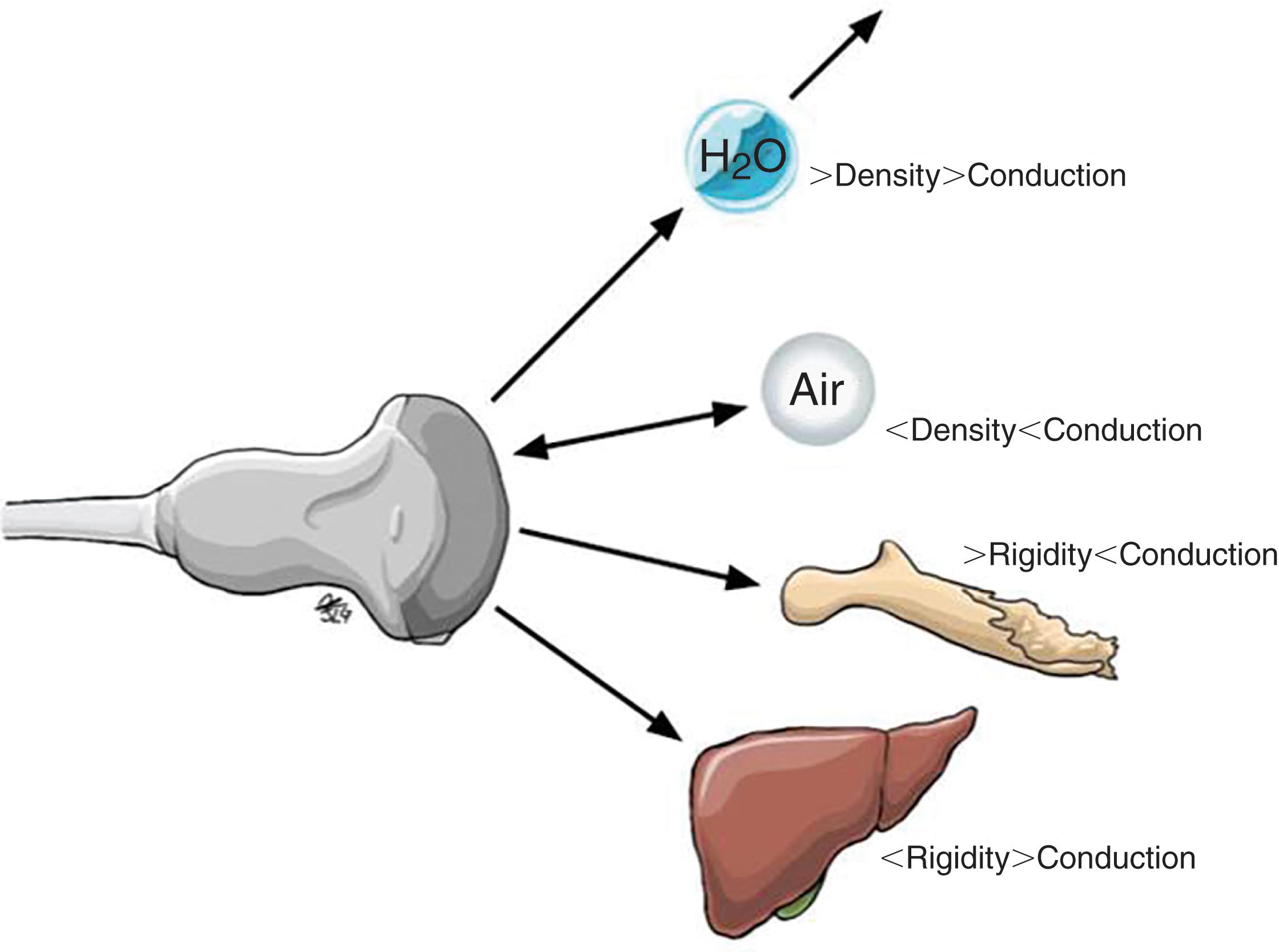 FIGURE 2, Relationship between ultrasound, density, and rigidity.