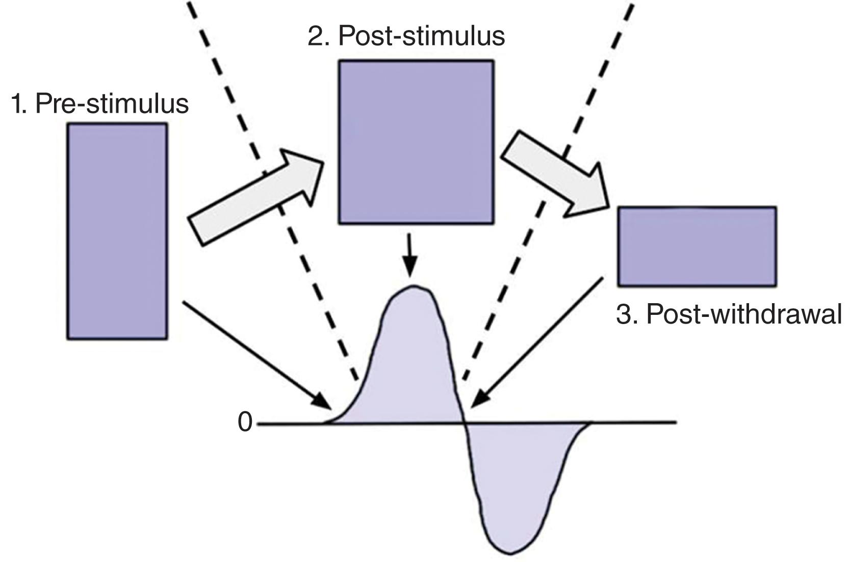 FIGURE 4, Piezoelectric effect.