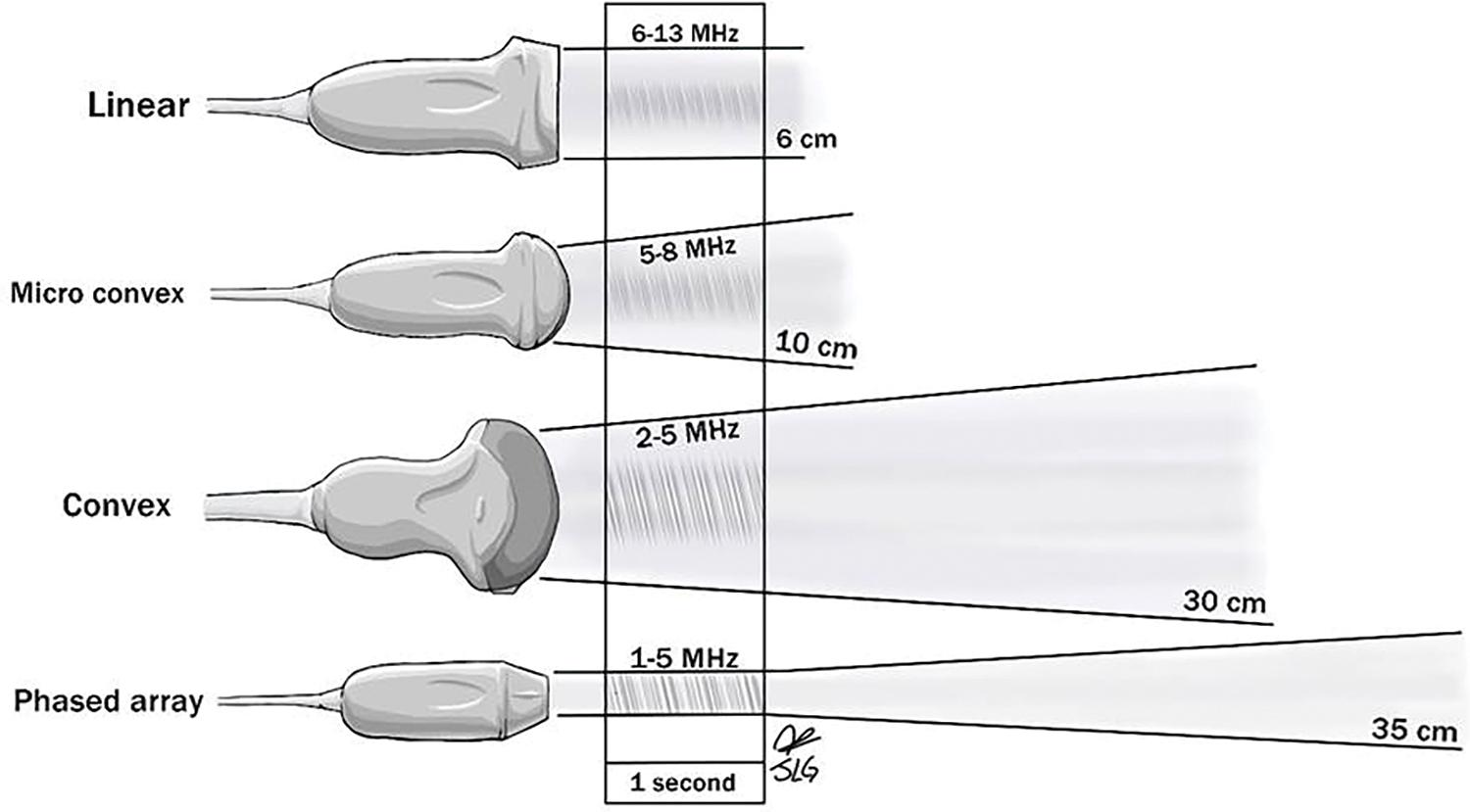 FIGURE 6, Different types of transducers, sound frequencies used, and depths reached.