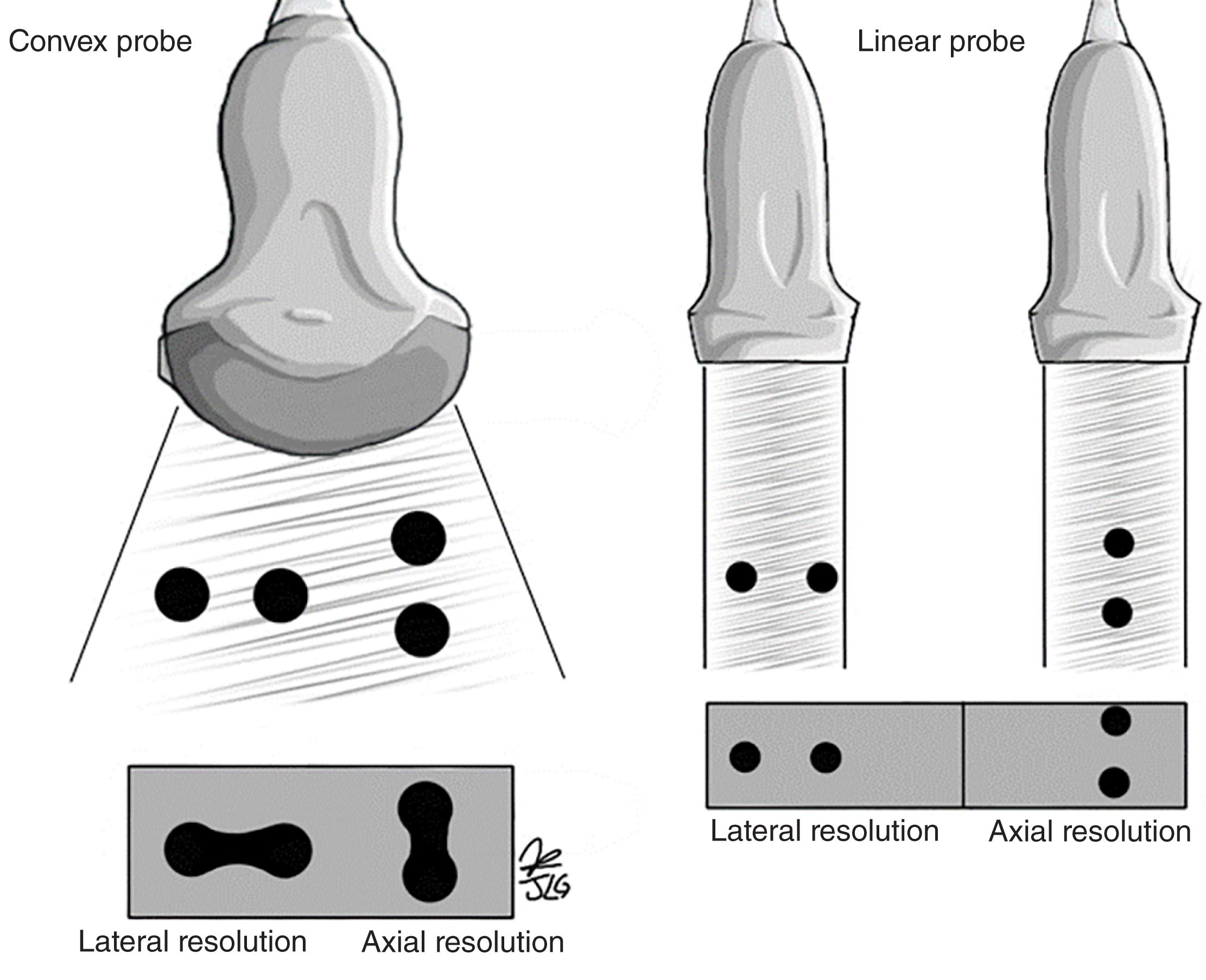FIGURE 7, Differences between transducer types and quality of lateral and axial resolution.