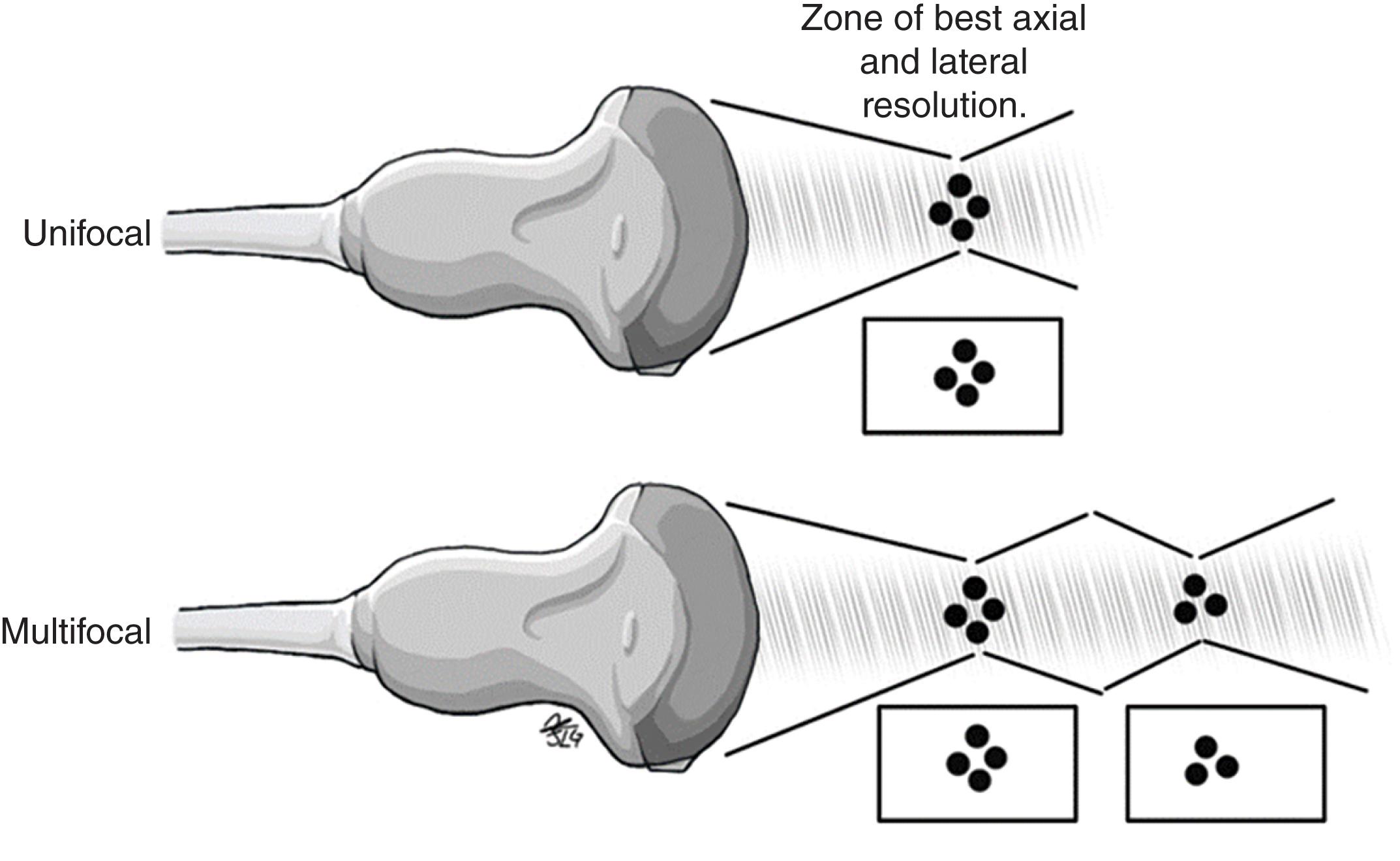 FIGURE 8, Graphic scheme of focus concept.