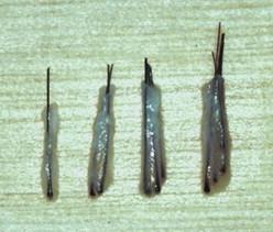 FIGURE 30.16, Dissected one-hair, two-hair, three-hair, and four-hair follicular units.