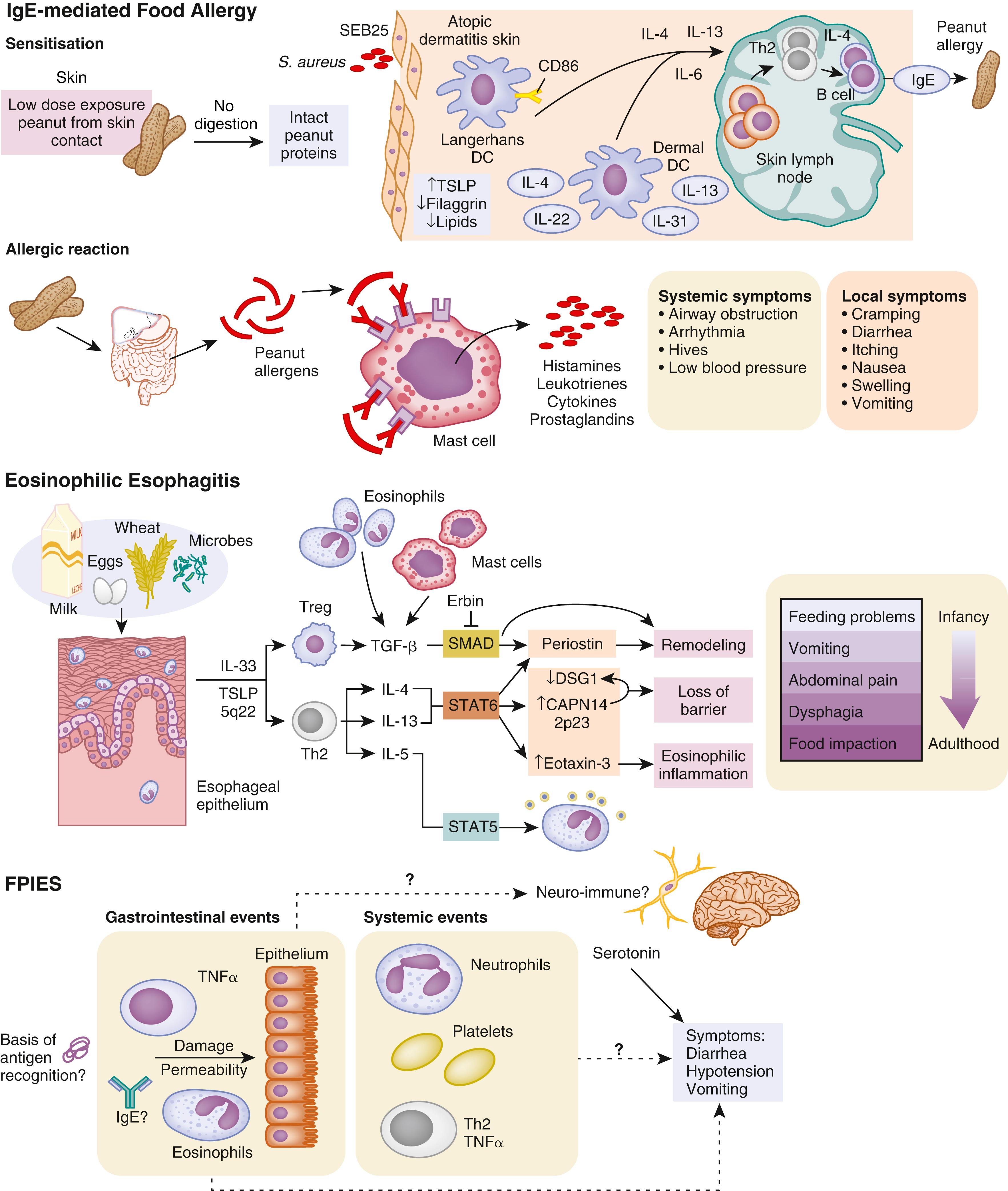 Fig. 10.1, Pathophysiology of food allergy.