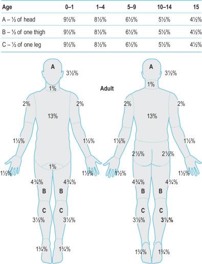 FIG. 4.10.1, Lund and Browder chart for calculating total body surface area burned.