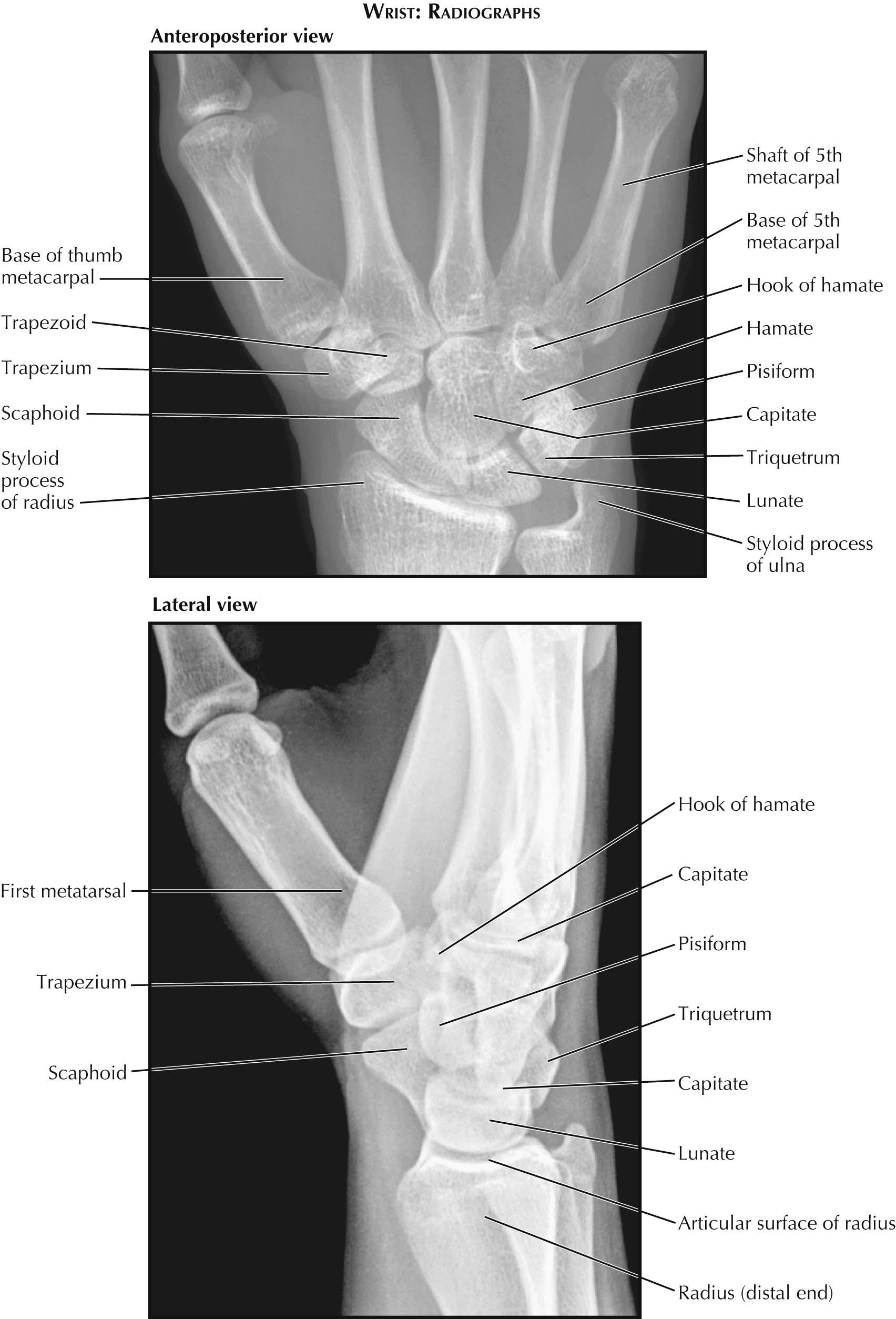 Plate 3-4