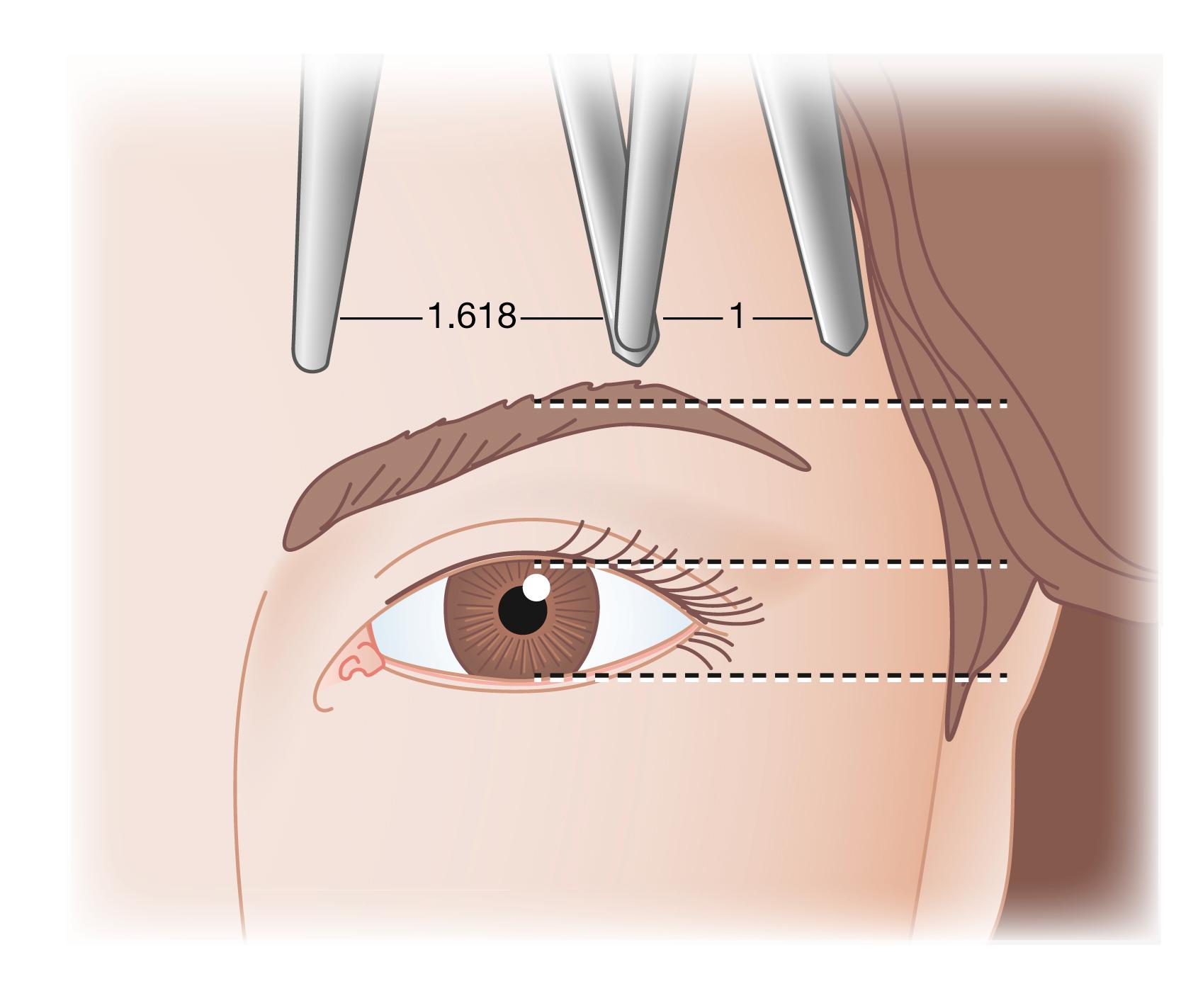 Fig. 63.12, The “golden eyebrow” arch. The position of the arch of the attractive eyebrow is also described by the golden ratio.