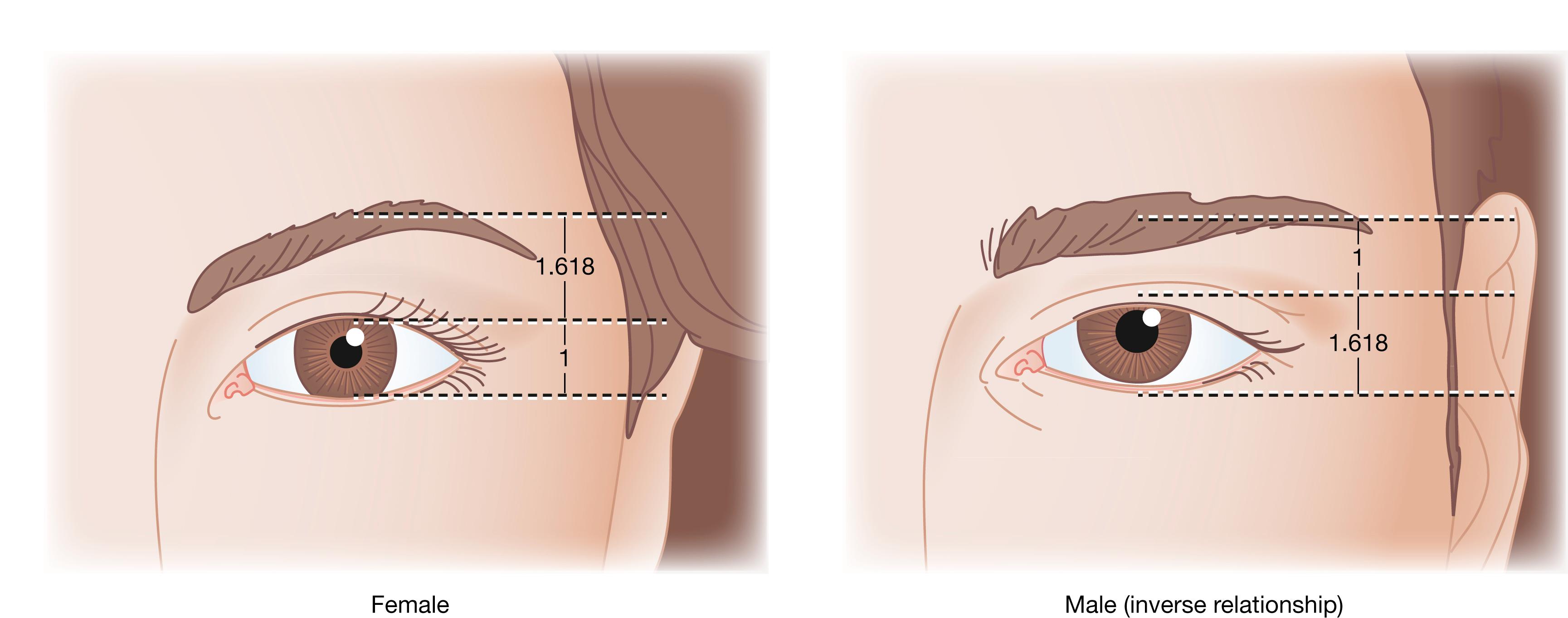 Fig. 63.13, The male “golden eyebrow.” For many men, the attractive eyebrow will fall in inverse relation to that of the female but remain in golden proportion to the palpebral aperture.