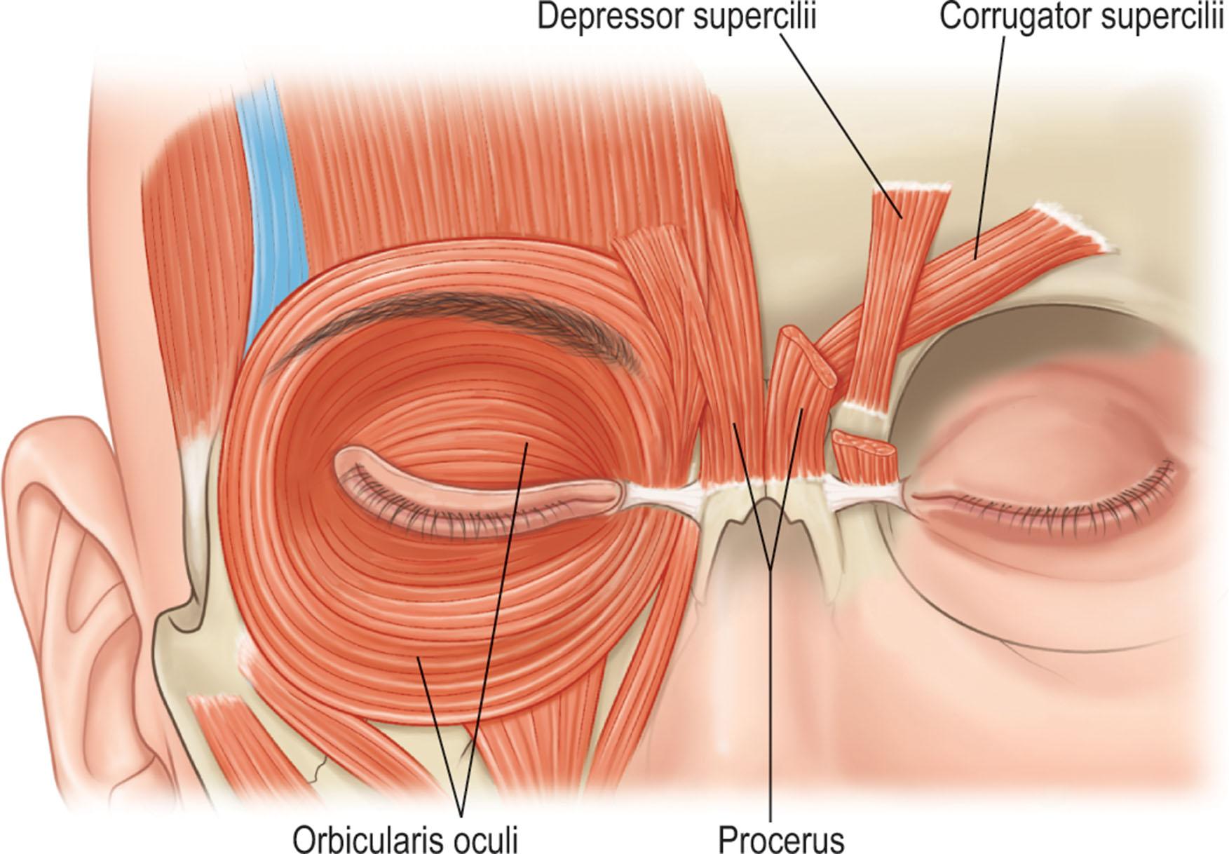 Figure 11.7, Glabellar frown muscles.