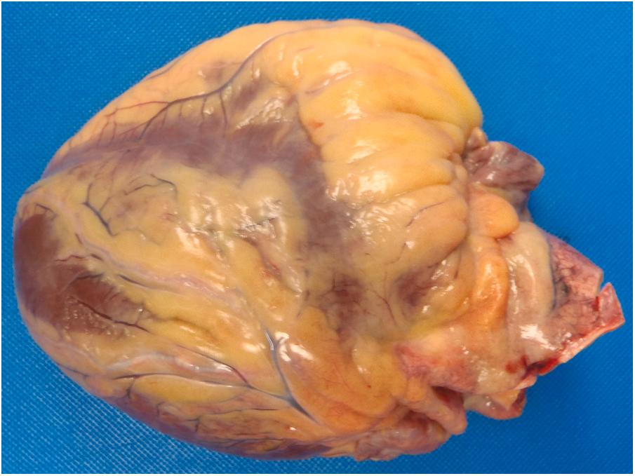 Figure 22.12, Normal heart, anterior view.