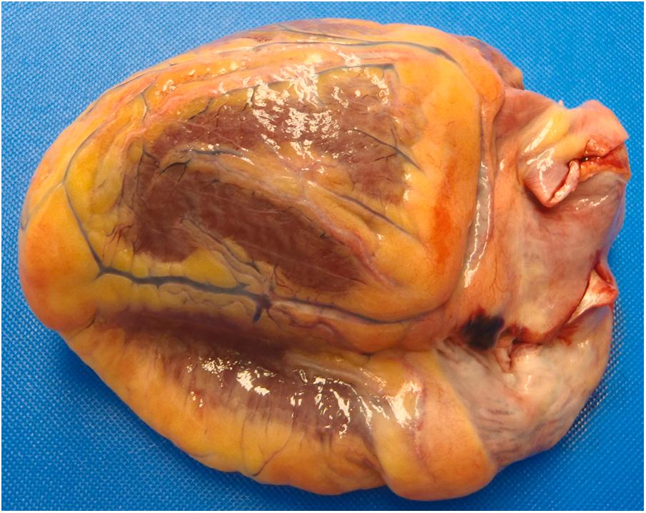 Figure 22.13, Normal heart, posterior view.