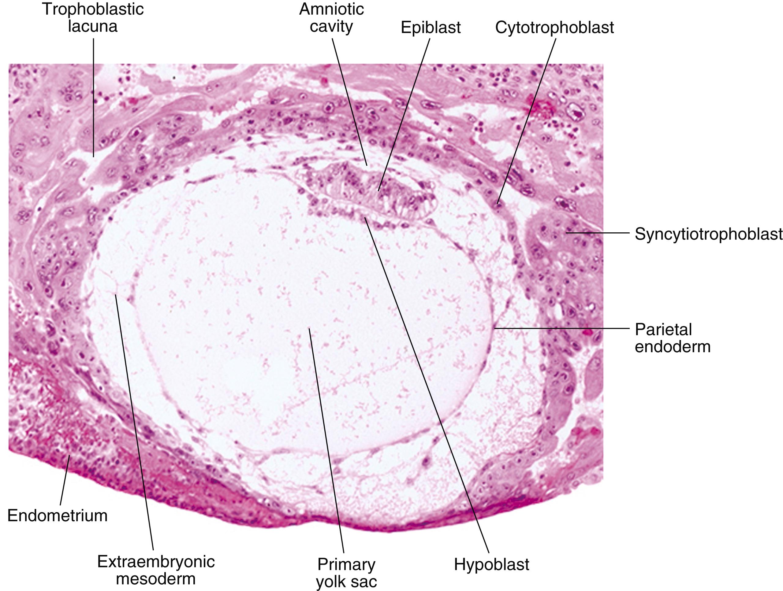 Fig. 5.4, Digital photomicrograph of a 12-day human embryo (Carnegie No. 7700) taken just as implantation within the endometrium is completed .