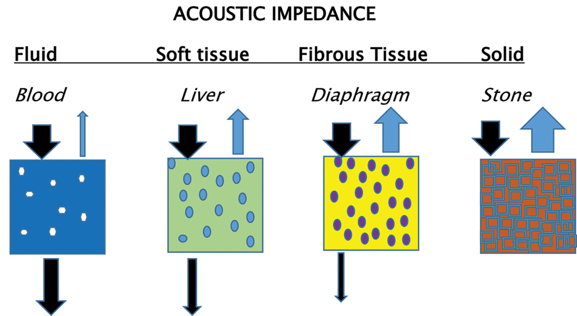 Fig. 1.12, Acoustic impedance is the measure of a material’s resistance to the propagation of sound. The strength of the reflection depends on the difference in acoustic impedance between the tissues, as well as the size of the interface, its surface characteristics, and its orientation with respect to the transmitted sound pulse. The greater the acoustic mismatch, the greater is the backscatter or reflection.