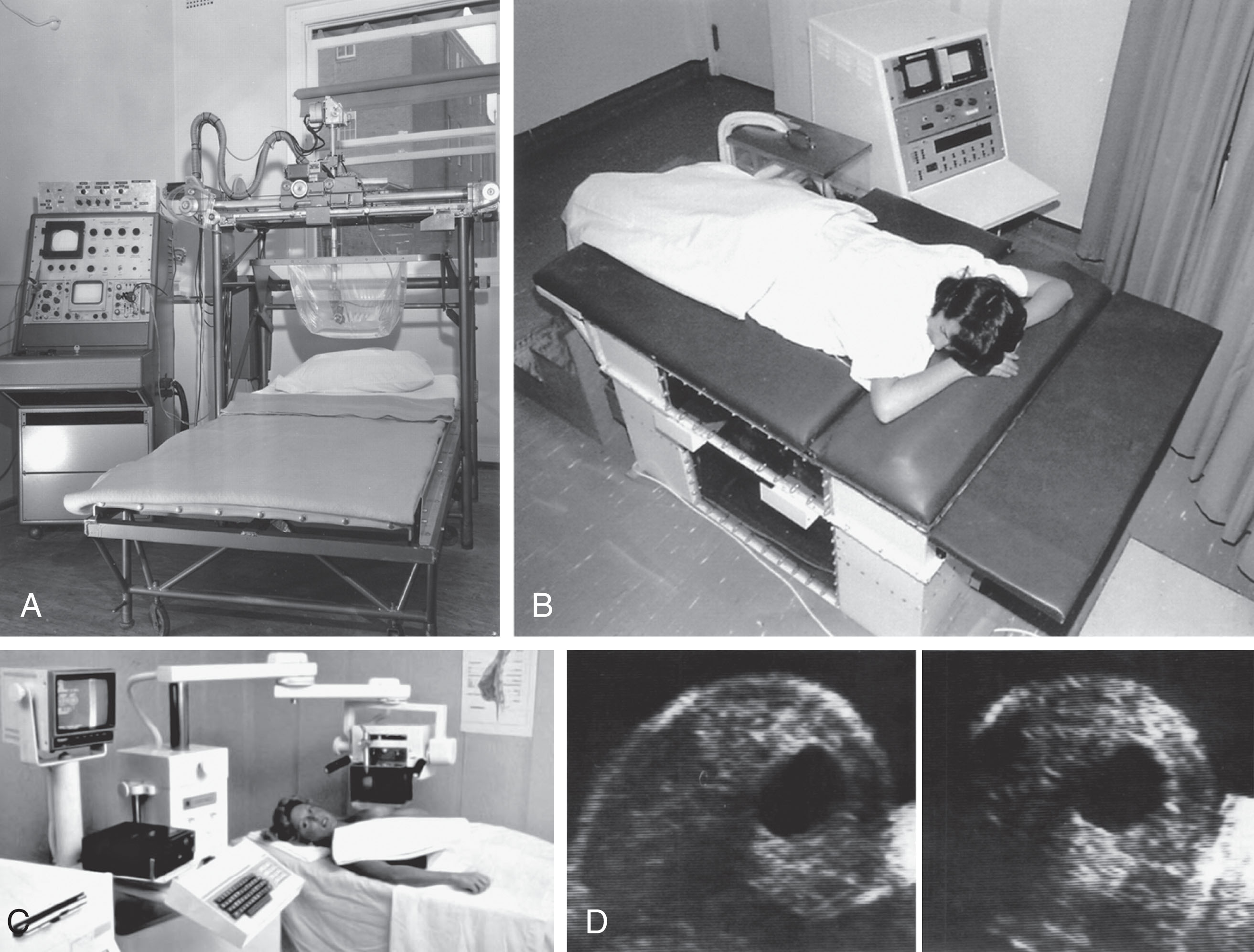 Fig. 1.5, (A) Dr. J. Stauffer Lehman designed a real-time water bath obstetric ultrasound system in Philadelphia. The weight of the water path compressed the mother’s inferior vena cava and caused her to become lightheaded. (B–C) Further developments of the water path system show the patient prone with the breast suspended in water or the patient supine with the water path compressing the breast. (D) Images of a breast cyst imaged with the breast suspended.