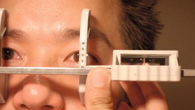 Figure 1.2, Globe position as measured using a Naugle exophthalmometer.